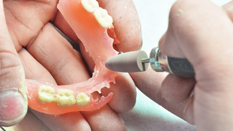 義歯の定期的調整